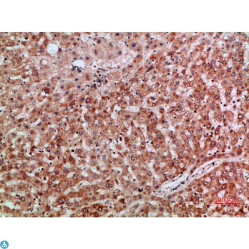 Polyclonal Rabbit anti-Human TMPO / TP / Thymopoietin Antibody (IF, WB)