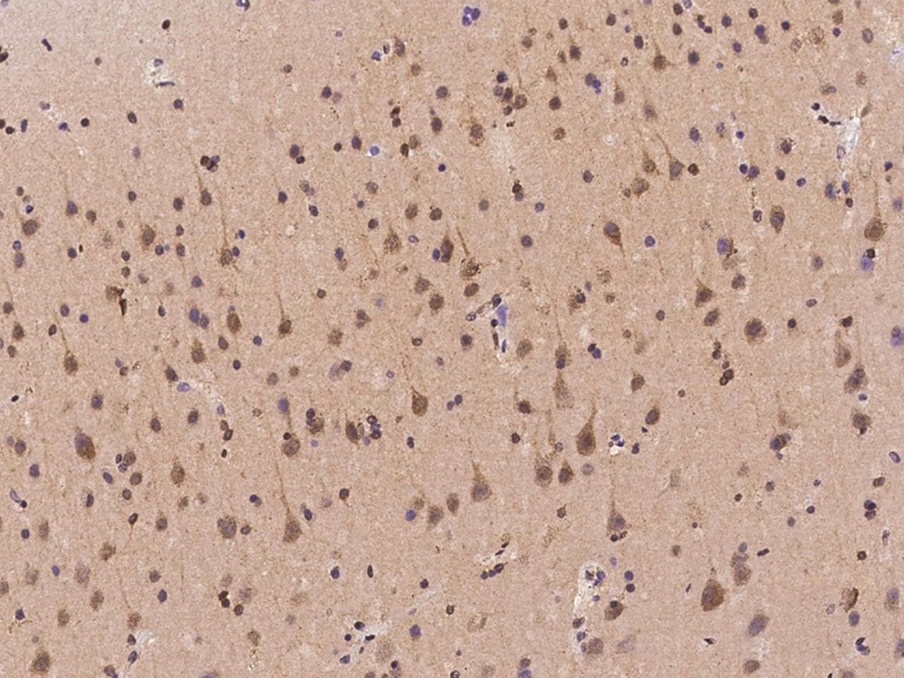 TMEM231 Antibody