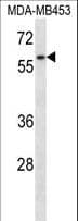 FANCG Antibody (aa540-568)