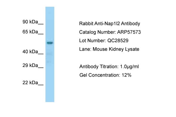 Polyclonal Rabbit anti-Mouse NAP1L2 / BPX Antibody (aa119-168, WB)