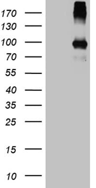 Monoclonal Mouse anti-Human PAMR1 Antibody (clone OTI4E2, Carrier-free, aa338-559, WB)
