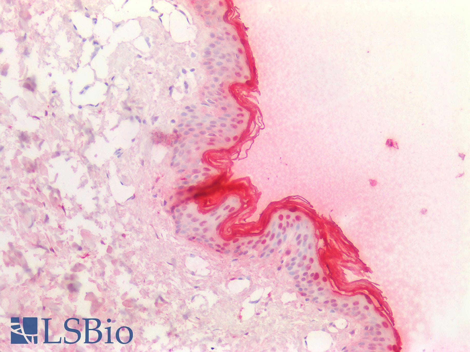PathPlus™ FLG / Filaggrin Antibody (N-Terminus)
