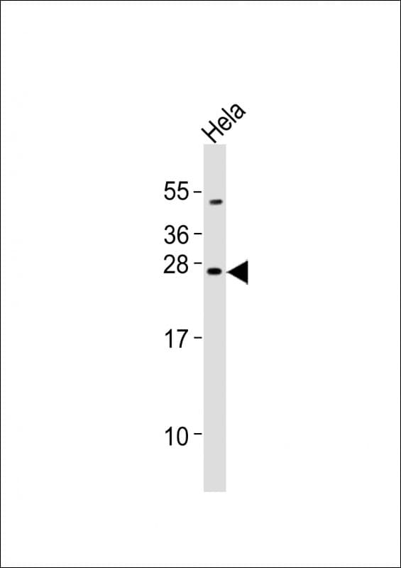 NEUROG2 / NGN2 / Neurogenin 2 Antibody (aa247-282)