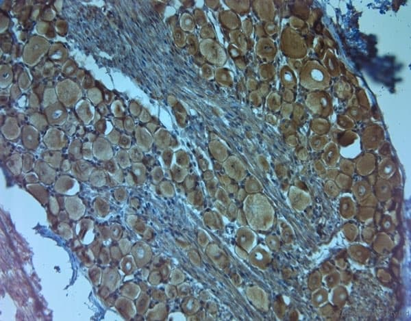 NTRK3 / TRKC Antibody (Extracellular Domain)