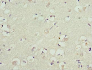 KCNIP2 / KCHIP2 Antibody