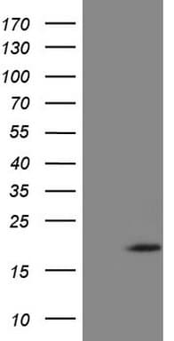 ZNF69 Antibody (clone OTI3C3)