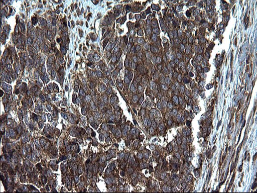 Monoclonal Mouse anti-Human PDCD6IP / ALIX Antibody (clone OTI1A4, IHC, WB)
