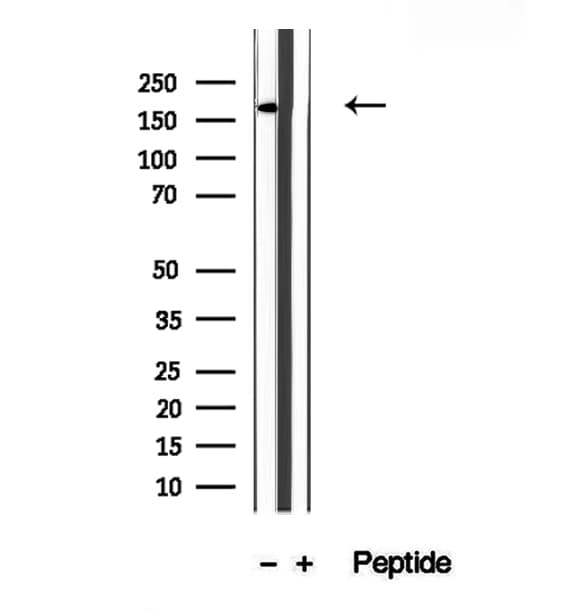 Polyclonal Rabbit anti-Human KIDINS220 / ARMS Antibody (IHC, IF, WB)