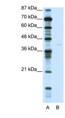 KCNA7 / Kv1.7 Antibody (C-Terminus)