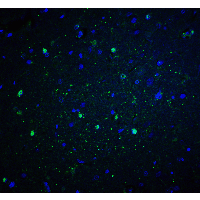 CYBB / NOX2 / gp91phox Antibody
