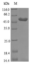 D-2-hydroxyisocaproate dehydrogenase (Lactobacillus paracasei) Protein (Recombinant 10His-SUMO, N-terminus + Myc, C-terminus)