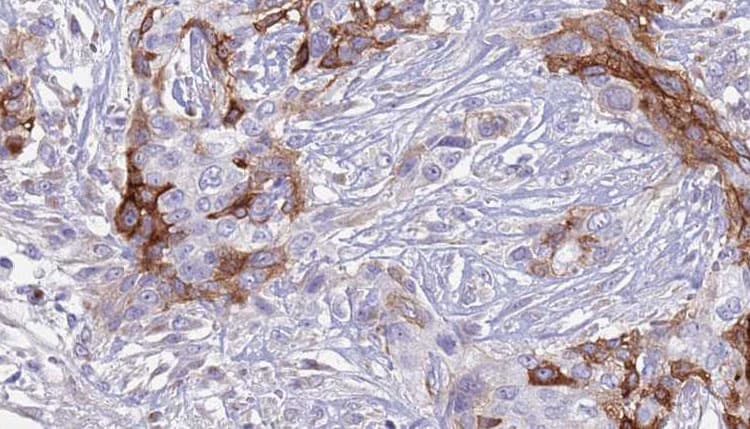 SLC18A2 / VMAT2 Antibody