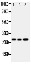Polyclonal Rabbit anti-Human OSM / Oncostatin M Antibody (aa181-198, IHC, WB)