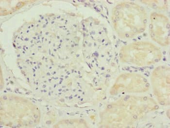 TAMM41 / C3orf31 Antibody