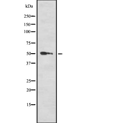 RXTA / RXR-Alpha Antibody
