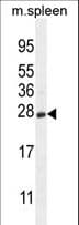 Polyclonal Rabbit anti-Human CRYGS Antibody (aa133-162, WB)