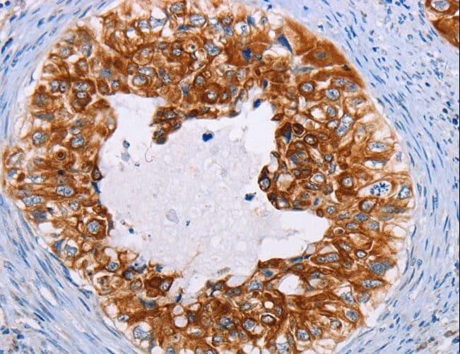 KRT13 / CK13 / Cytokeratin 13 Antibody