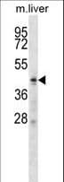 Polyclonal Rabbit anti-Human ZDHHC6 Antibody (aa288-317, WB)