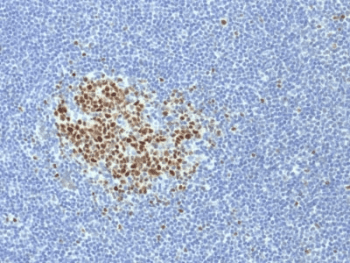 Monoclonal Mouse anti-Human BCL6 Antibody (clone BCL6/1718, IHC)