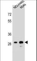 DHRS4L1 Antibody (aa222-250)
