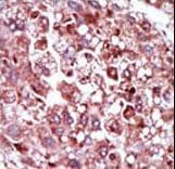 PCK1 Antibody (aa592-622)