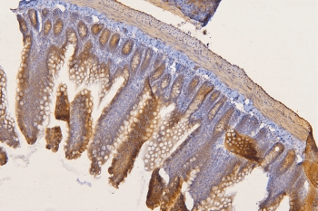 Polyclonal Rabbit anti-Human SFRP1 Antibody (IHC, WB)