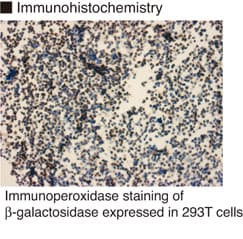 GLB1 / Beta-Galactosidase Antibody (clone 5A3)