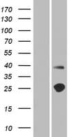 TMEM215 Protein (Over-Expression Lysate Myc-DDK (Flag))