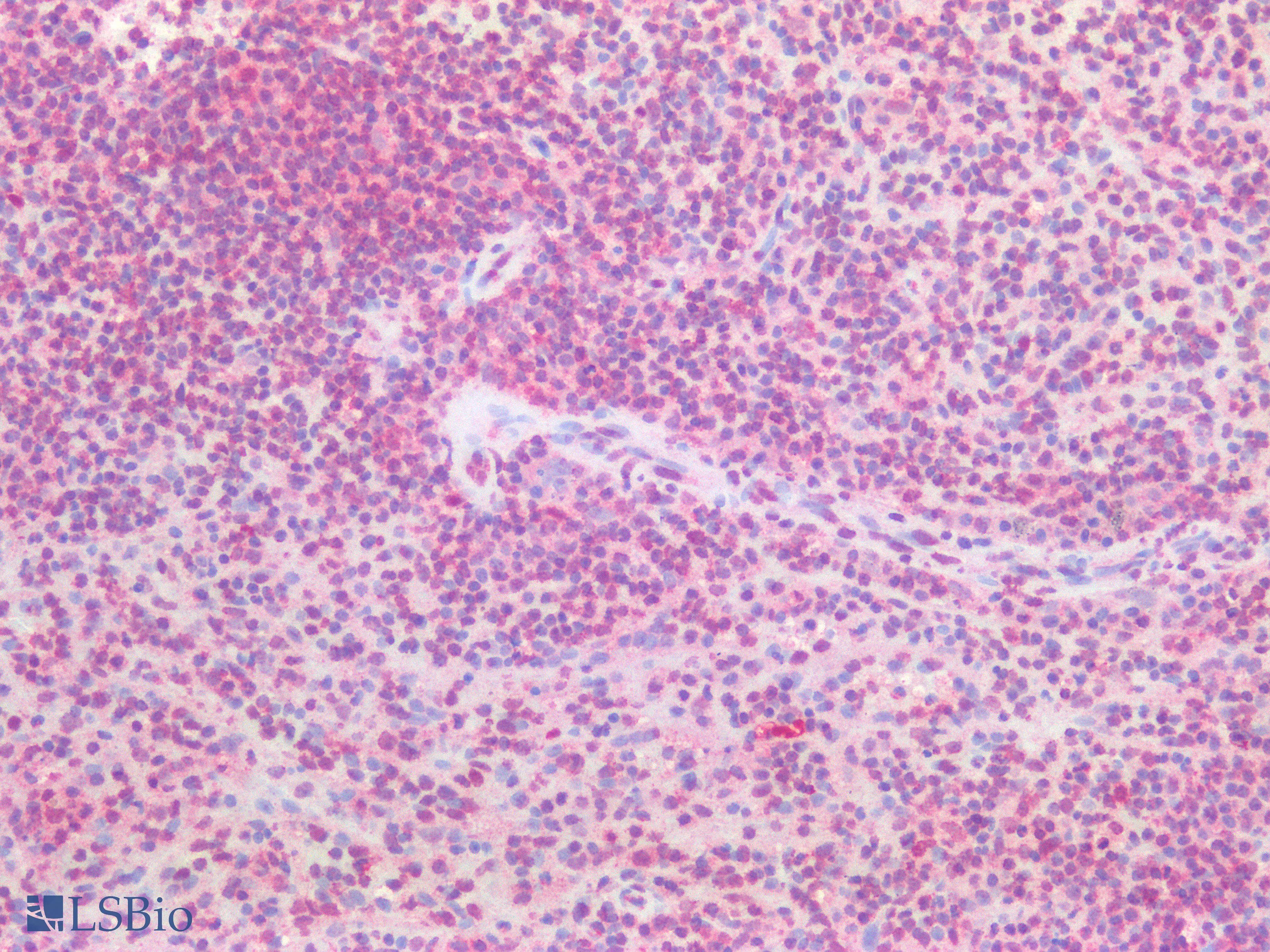 PathPlus™ ERG Antibody (clone 8A9)