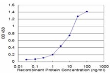 IHC-plus™ ACTA2 / Smooth Muscle Actin Antibody (clone 1D11-2B9)