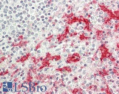 IHC-plus™ FCGR3A / CD16A Antibody