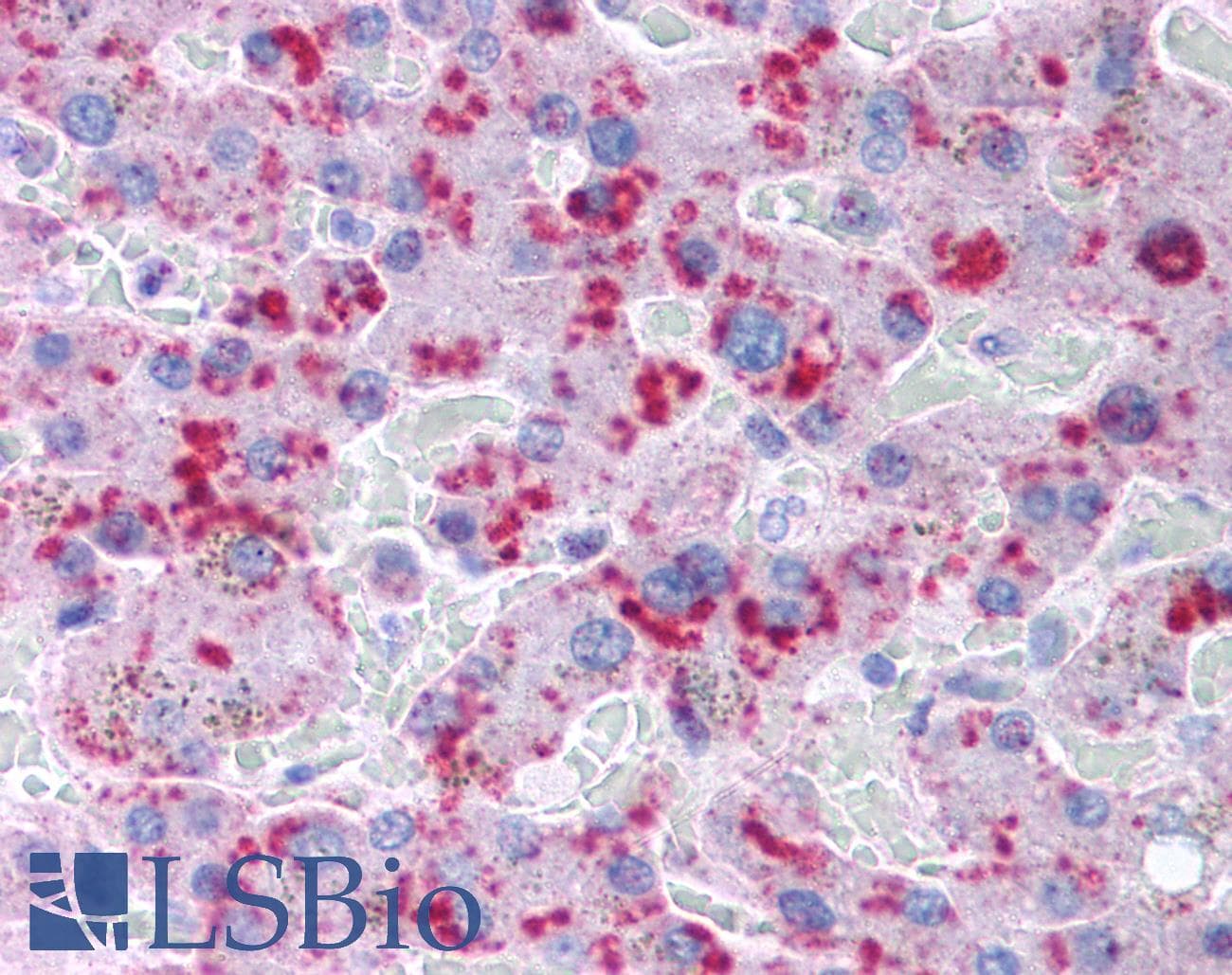 IHC-plus™ MLXIPL / CHREBP Antibody (aa50-150)