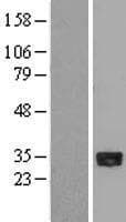 PHAP III / ANP32E Protein (Over-Expression Lysate Myc-DDK (Flag))