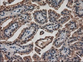 AMY2A / Pancreatic Amylase Antibody (clone OTI6D4)
