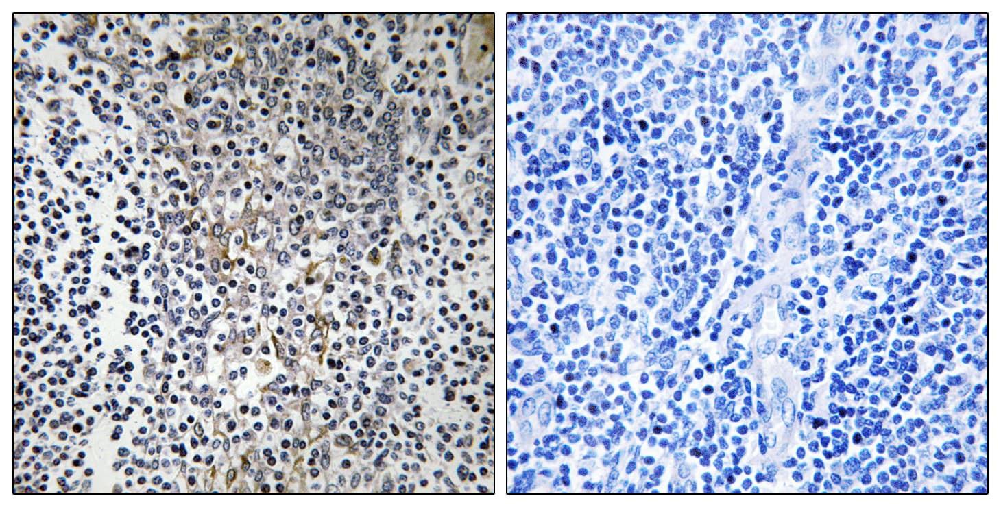 RPL23 / Ribosomal Protein L23 Antibody (aa51-100)