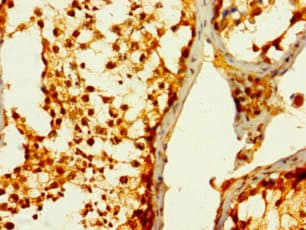 Polyclonal Rabbit anti-Human STC1 / Stanniocalcin Antibody