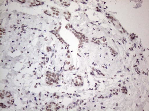 NR2C2 / TAK1 Antibody (aa1-241, clone OTI2H2)