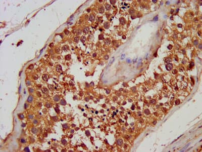 TG / Thyroglobulin Antibody