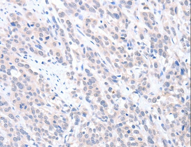ABLIM1 Antibody