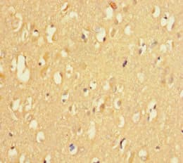 KDM4A / JHDM3A / JMJD2A Antibody