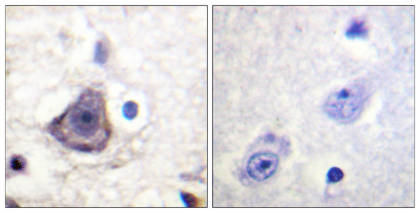 ERBB3 / HER3 Antibody (phospho-Tyr1222)