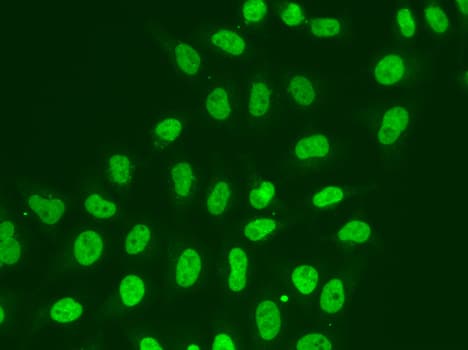 POLR2J Antibody
