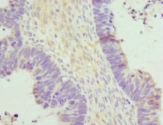 Polyclonal Rabbit anti-Human HERPUD1 / HERP Antibody (IHC)