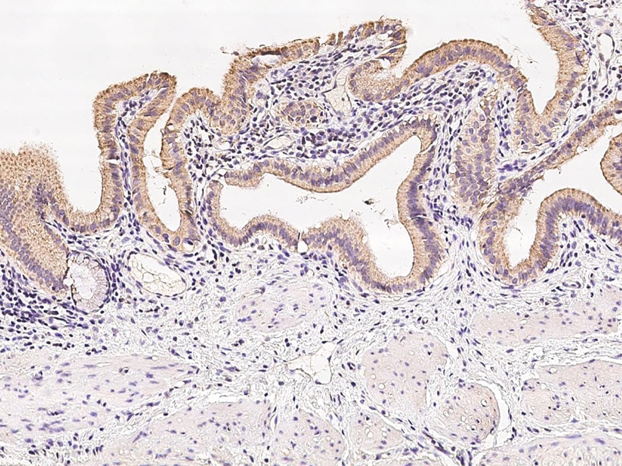 GPD2 Antibody