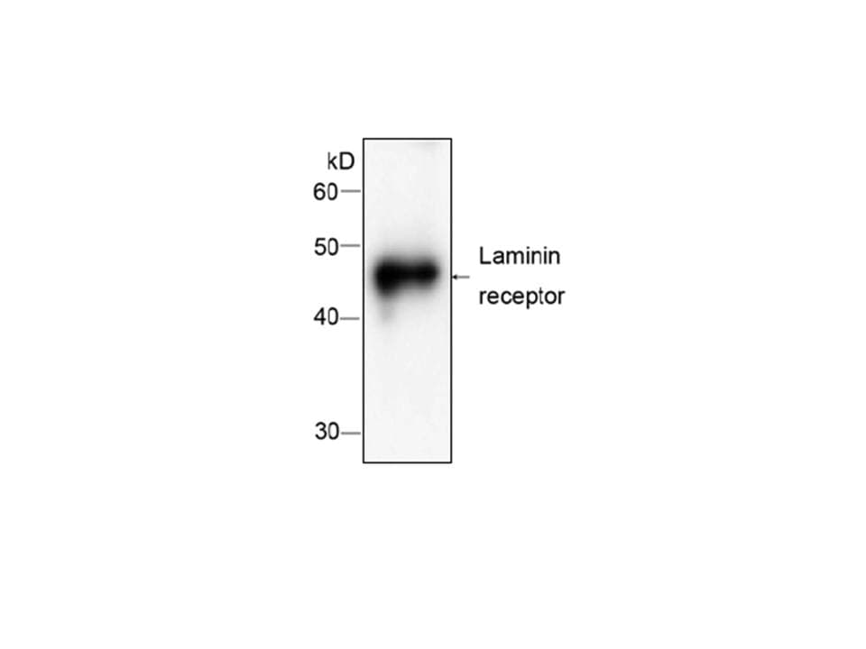 Monoclonal Mouse anti-Human RPSA / Laminin Receptor Antibody (WB)