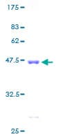 Human LSM1 Protein (Recombinant GST)