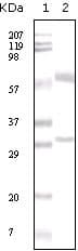 IHC-plus™ ITIH1 Antibody (aa410-592, clone 2B7)