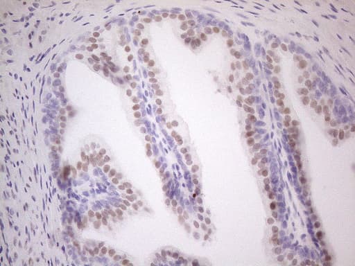 AR / Androgen Receptor Antibody (aa420-659, clone OTI2E6, Carrier-free)