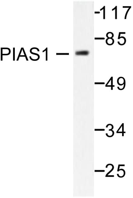 Polyclonal Rabbit anti-Human PIAS1 Antibody (Gly24, IHC, WB)