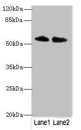 TRIM55 / MURF2 Antibody